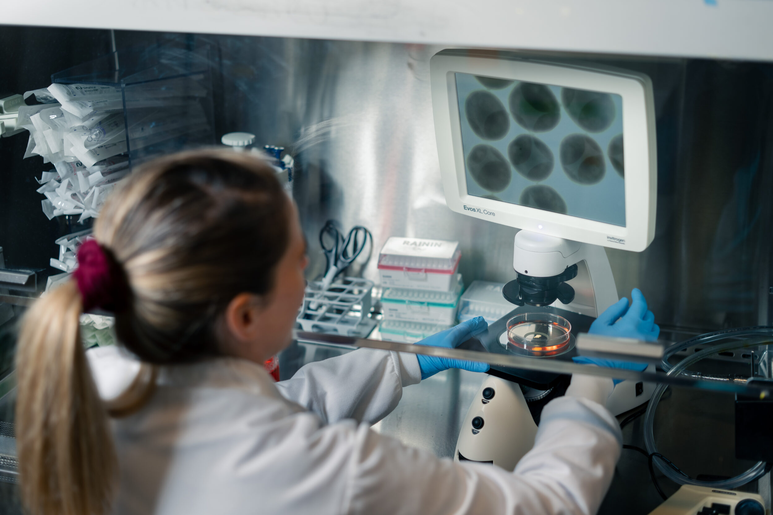 HS-SCI-ORGANOIDS Noelia Antón Bolaños looks at organoids and their rosettes