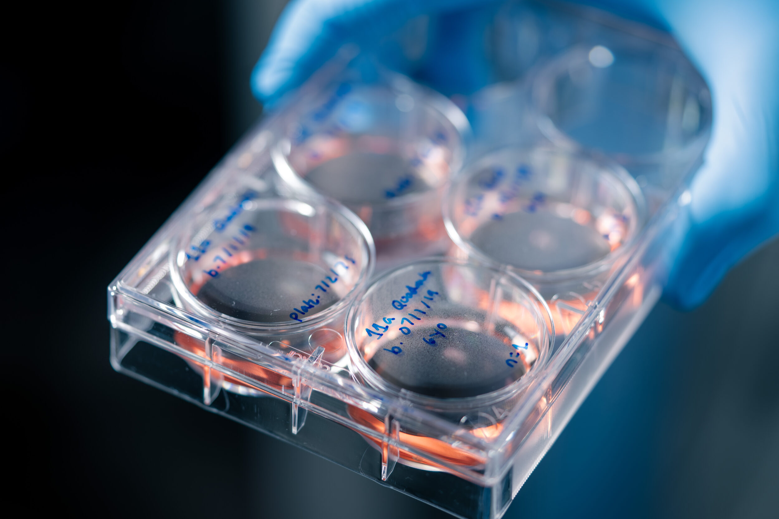 HS-SCI-ORGANOIDS A few of the older organoids are 6 years ol