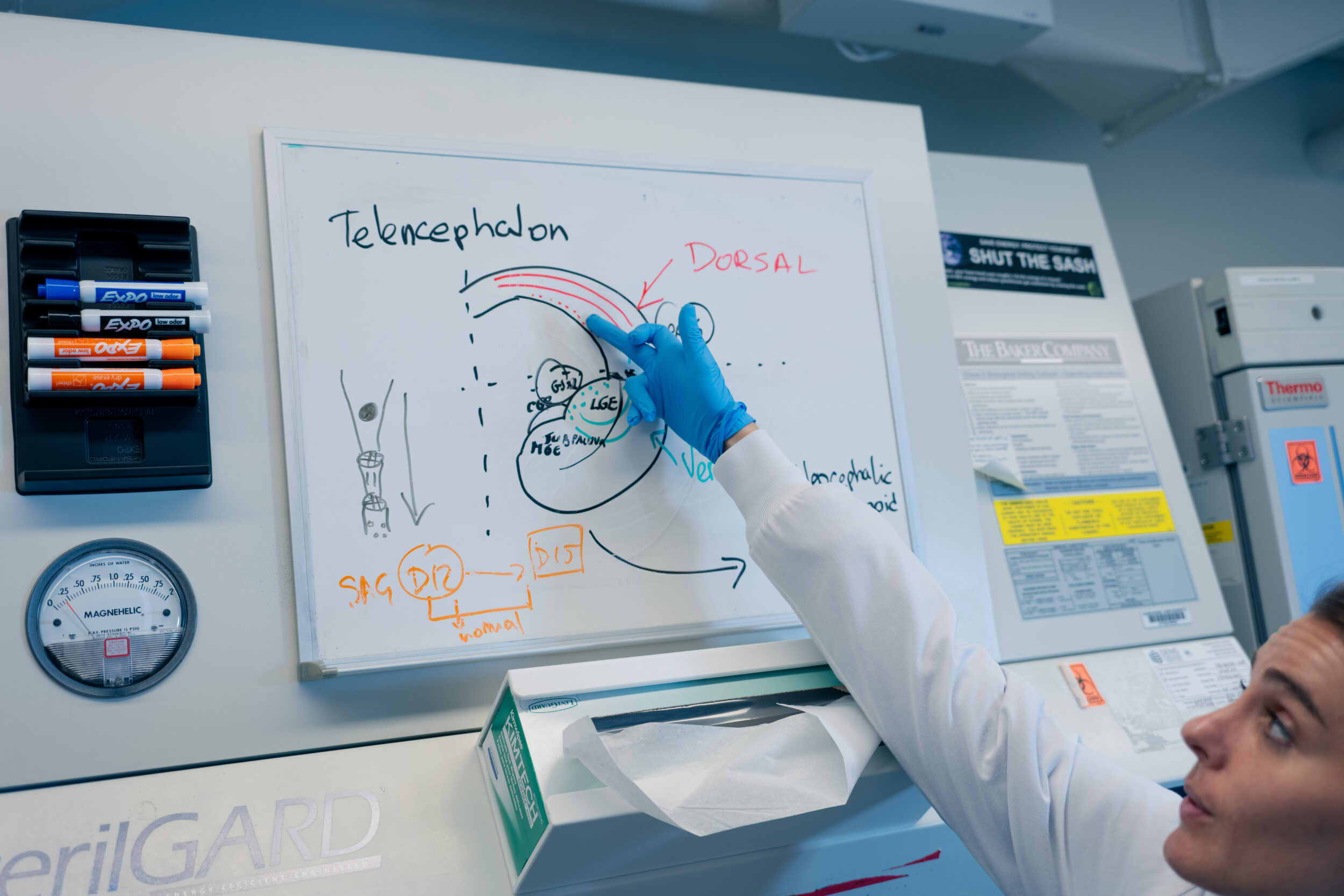 HS-SCI-ORGANOIDS Noelia Antón Bolaños points out the different types of cells that must be grown and joined to create a more complex brain-like structure